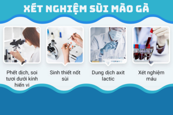 Thời gian ủ bệnh sùi mào gà là bao lâu?